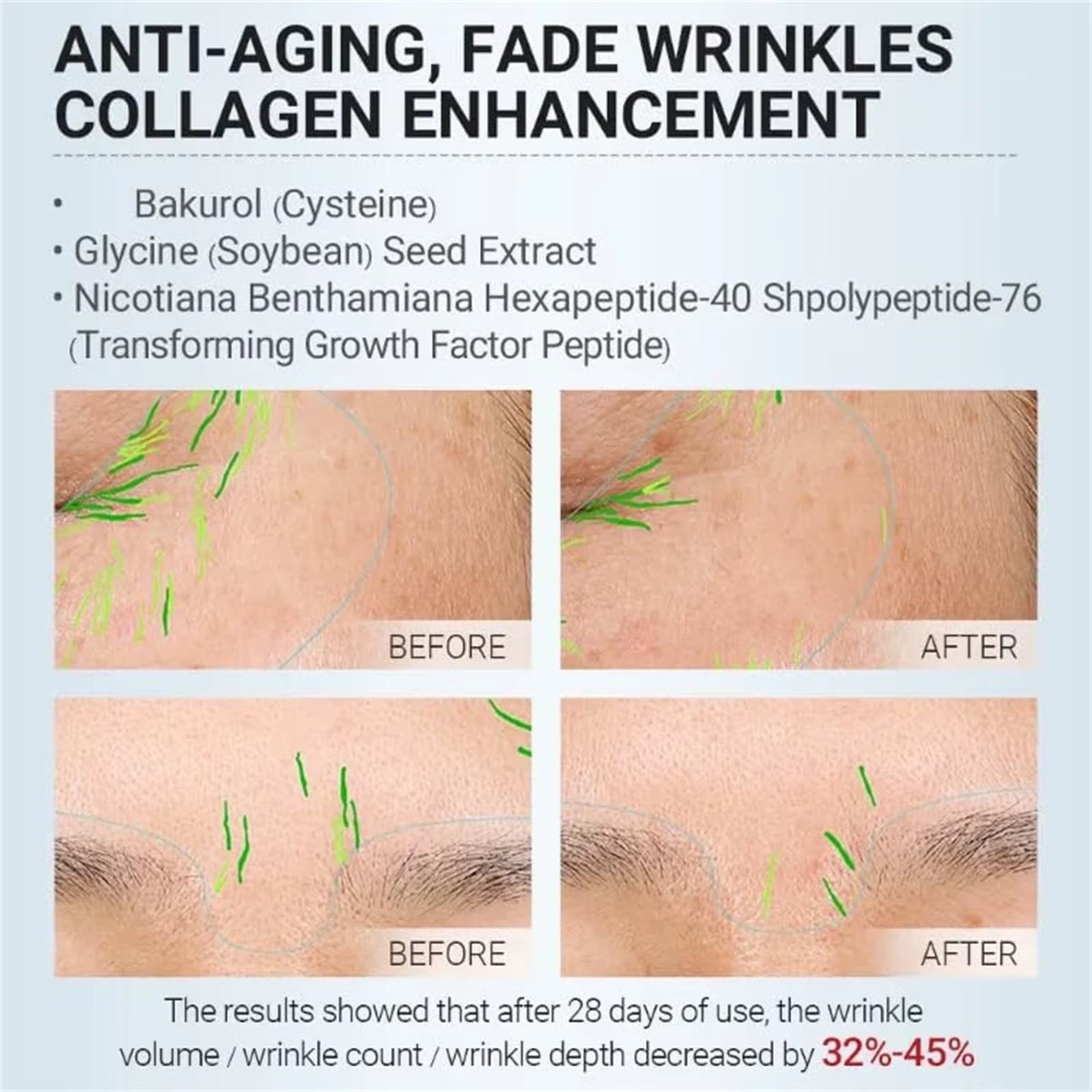 Bakuchiol Retinol Anti - Aging Serum – Collagen - Boosting, Gentle Rejuvenation for Smoother, Firmer, Youthful Skin - Gotcha Girl Cosmetics Gotcha Girl Cosmetics61b1c384-4210-4d63-96ef-717463a61218