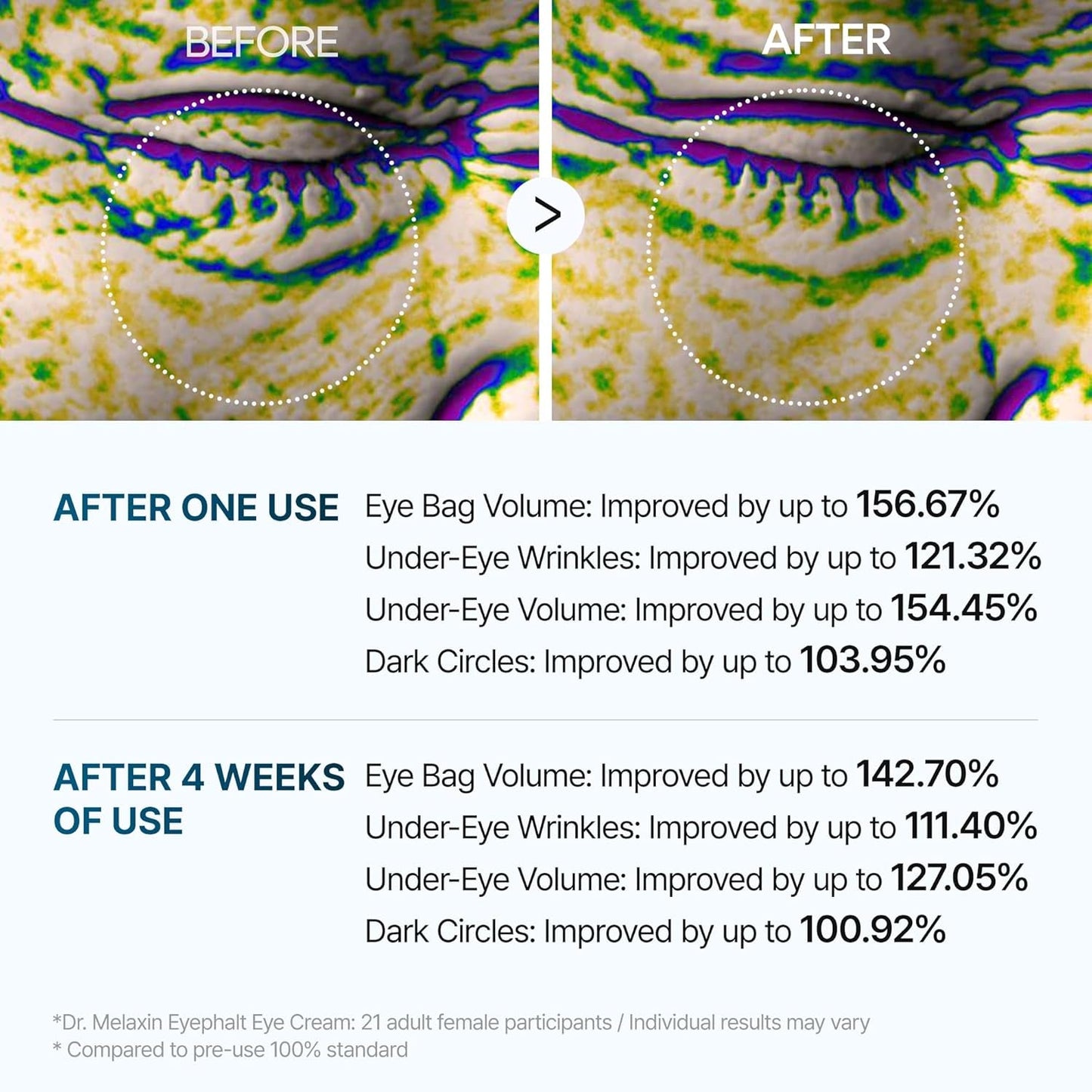 Eyephalt Miracle Repair Cream – EGF - Infused Under Eye Savior (0.33 Fl.Oz) - Gotcha Girl Cosmetics Gotcha Girl Cosmetics5b1d3162-07a5-4a64-aa09-b553c00a0574
