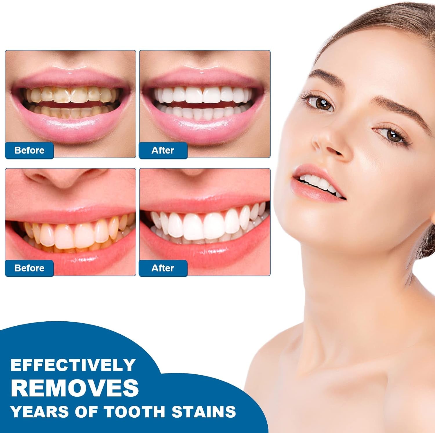 Teeth Whitening Pen,Teeth Whitening Essence,Teeth Whitening Gel,Teeth Stain Remover to Whiten Teeth,Intensive Stain Removal Teeth Reduce Yellowing (2Pcs) - Gotcha Girl Cosmetics Gotcha Girl Cosmetics31d7e4a6-157e-4706-a31e-9f48895253db