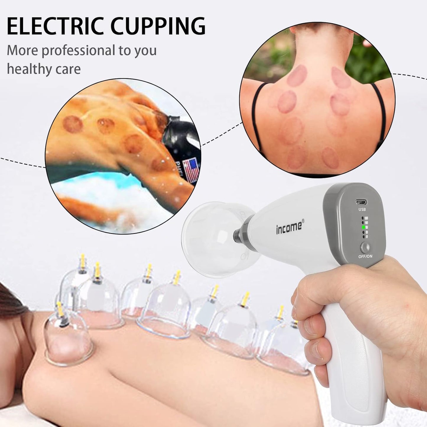 Electric Cupping Therapy Set,Portable Chinese Cupping Therapy Machine with Pump,Body Massage Scraping Care Device, 4 Vacuum Suction Cups,Electric Cupping Massager Kit for Homeuse - Gotcha Girl Cosmetics Gotcha Girl Cosmeticse54f891e-3e8b-4526-9eac-9888f4a1da3b