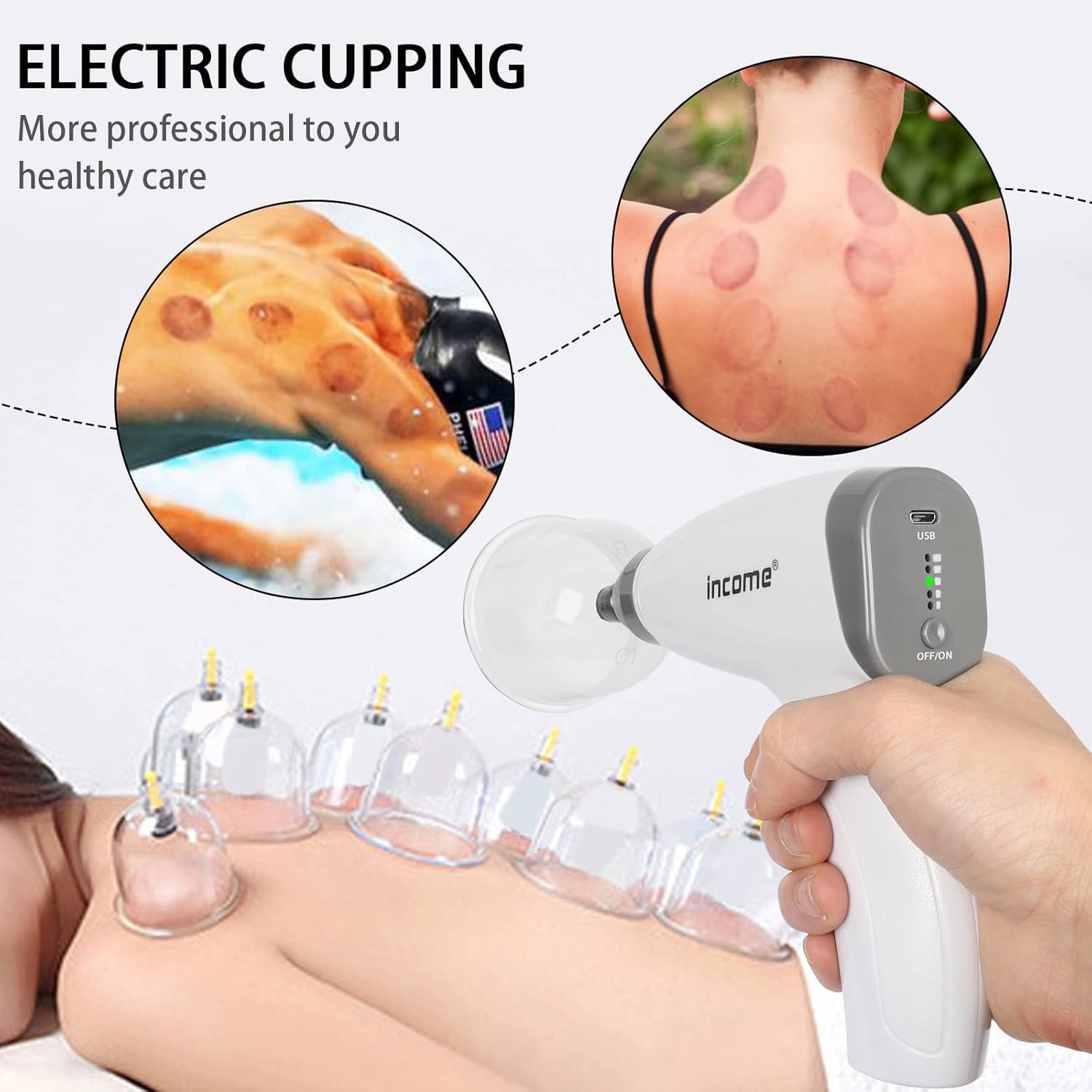 Electric Cupping Therapy Set,Portable Chinese Cupping Therapy Machine with Pump,Body Massage Scraping Care Device, 4 Vacuum Suction Cups,Electric Cupping Massager Kit for Homeuse - Gotcha Girl Cosmetics Gotcha Girl Cosmeticse54f891e-3e8b-4526-9eac-9888f4a1da3b